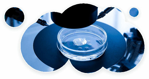 ivf ivf