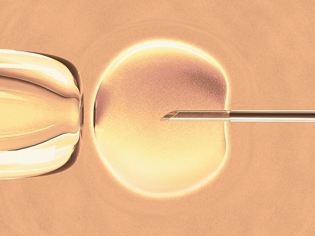 fecundacion-In-Vitro fecundación In Vitro