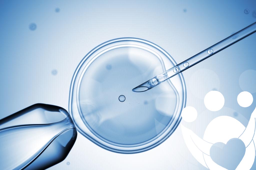 Erfolgsquoten bei Leihmutterschaftsprozessen 5 inseminacion