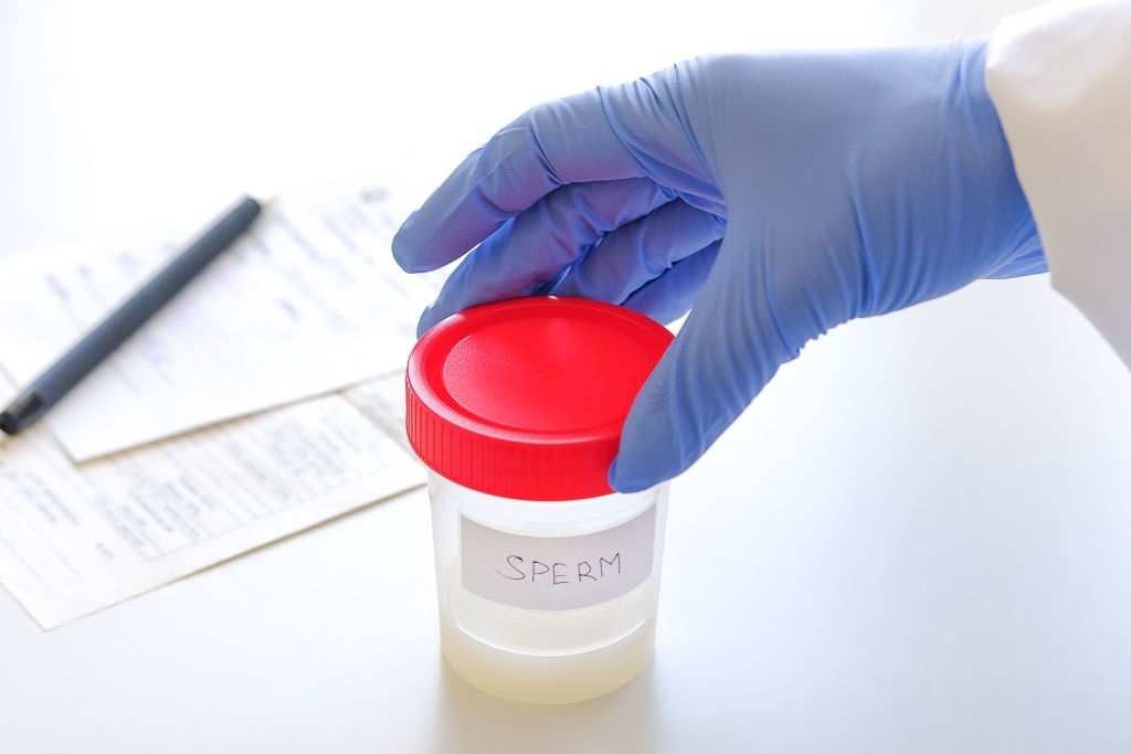 ¿Cómo tener un Esperma Saludable? ¿Cómo tener un Esperma Saludable?