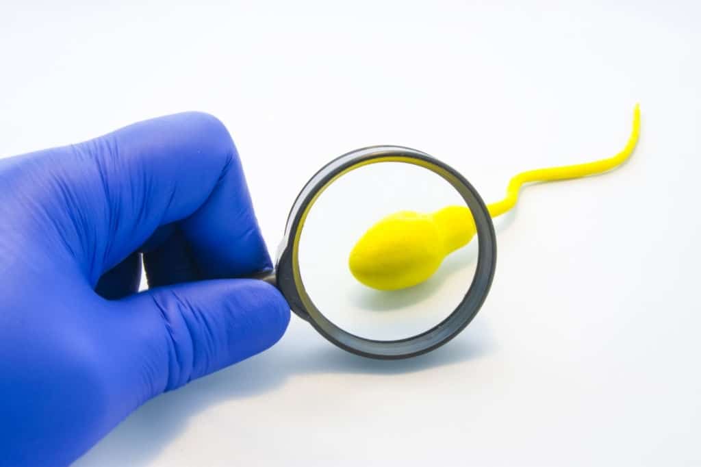 Conteo bajo de espermatozoides 2 Conteo bajo de espermatozoides