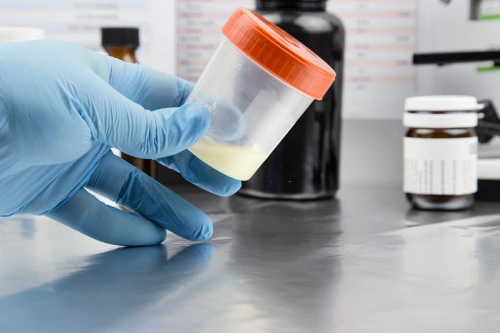 Conteo bajo de espermatozoides 5 Conteo bajo de espermatozoides