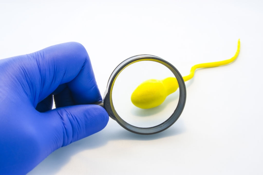¿Qué es el conteo de espermatozoides? 2 El secreto del éxito ¿Como es el camino de los espermatozoides?
