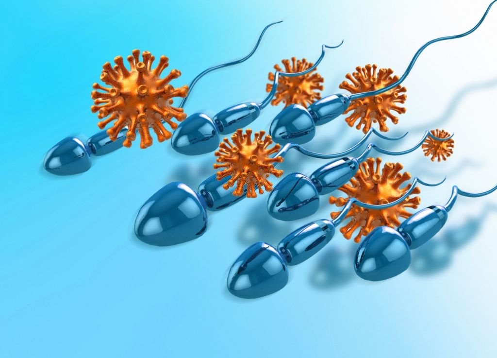 ¿Qué es el conteo de espermatozoides? 4 ¿Qué es el conteo de espermatozoides?