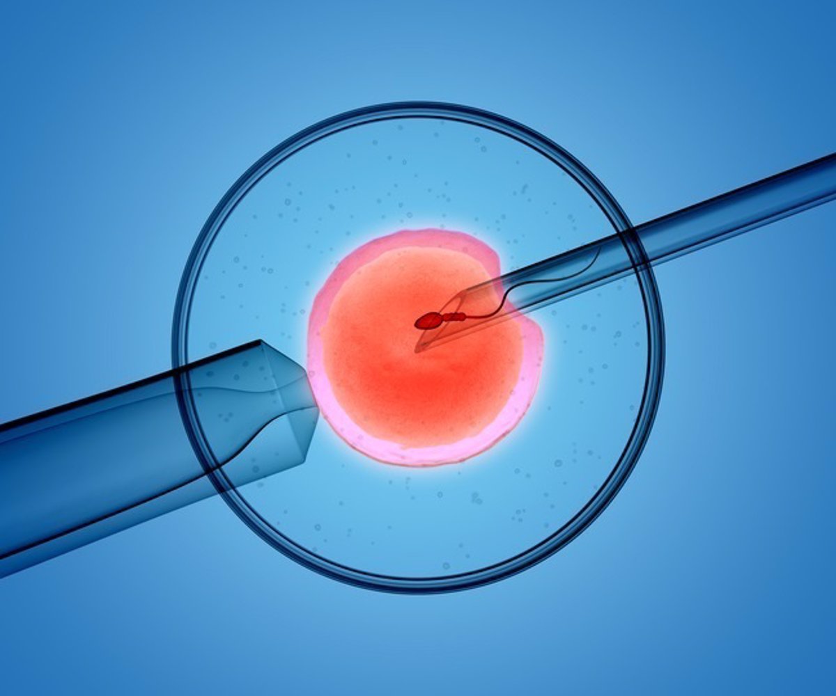 Fecundación in vitro, embrión, óvulo, FIV fertilización in vitro 4